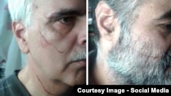 تصاویر انتشار یافته در شبکه‌های اجتماعی، از چهره مجروح سعید مدنی (چپ) و سعید رضوی فقیه، پس از حمله روز شنبه