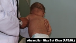 ارشیف: په شري ناروغۍ اخته افغان ماشوم